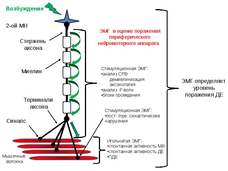 электронейромиография верхних конечностей цена